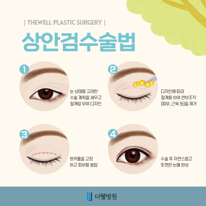 ce1284fc088b2abcacb9dca766c46b9e_1698892022_2447.jpg 더웰병원 ce1284fc088b2abcacb9dca766c46b9e_1698892022_2447