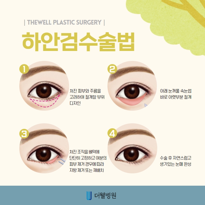 ce1284fc088b2abcacb9dca766c46b9e_1698892022_4074.jpg 더웰병원 ce1284fc088b2abcacb9dca766c46b9e_1698892022_4074