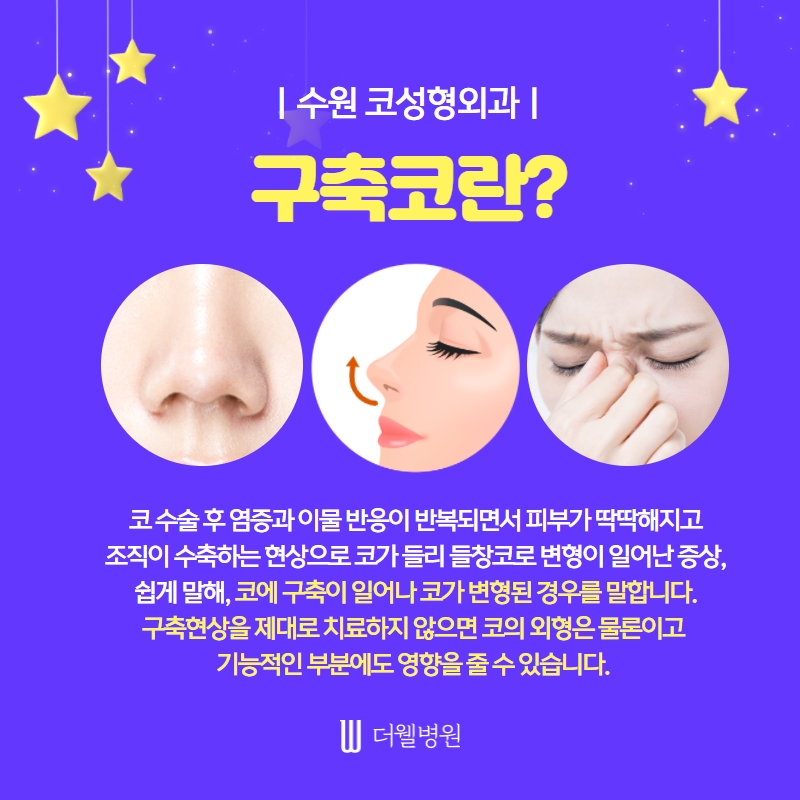 더웰병원 ce1284fc088b2abcacb9dca766c46b9e_1698892184_1261
