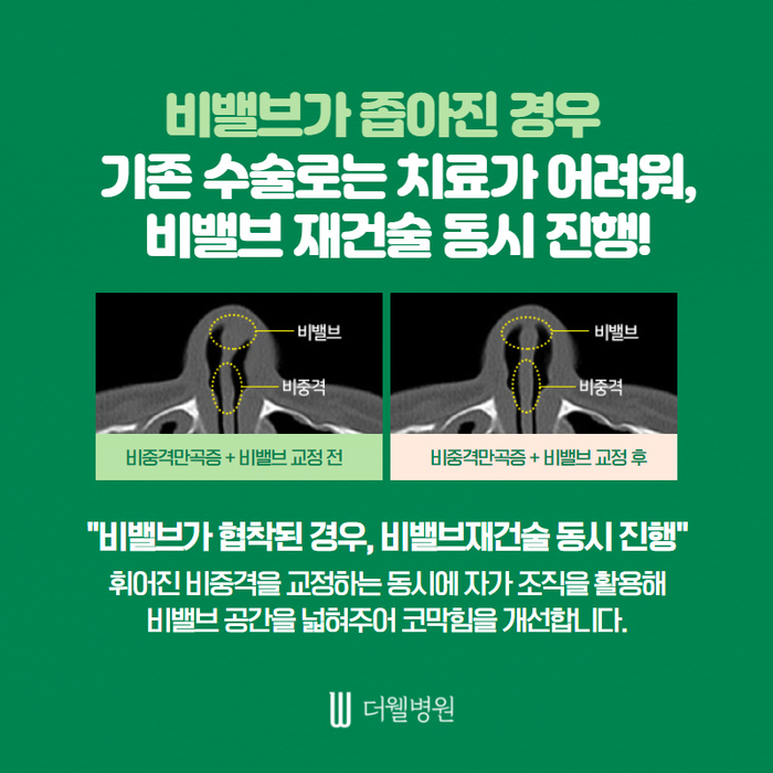 ce1284fc088b2abcacb9dca766c46b9e_1698892311_0315.jpg 더웰병원 ce1284fc088b2abcacb9dca766c46b9e_1698892311_0315