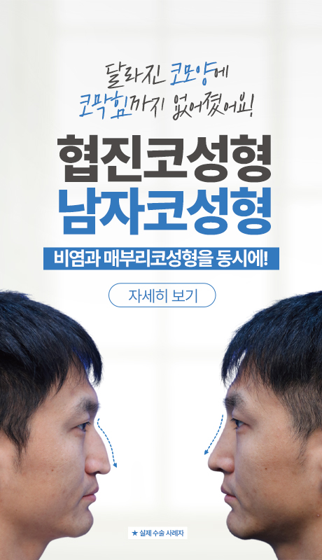 협진코성형 남자코성형