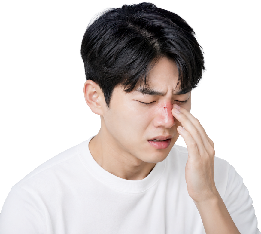 더웰병원 코뼈골절, 코뼈골절수술, 코뼈골절증상, 코뼈골절치료, 코수술, 코성형 더웰병원