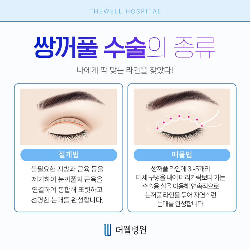 수원더웰병원 수원성형외과 쌍꺼풀수술 눈성형