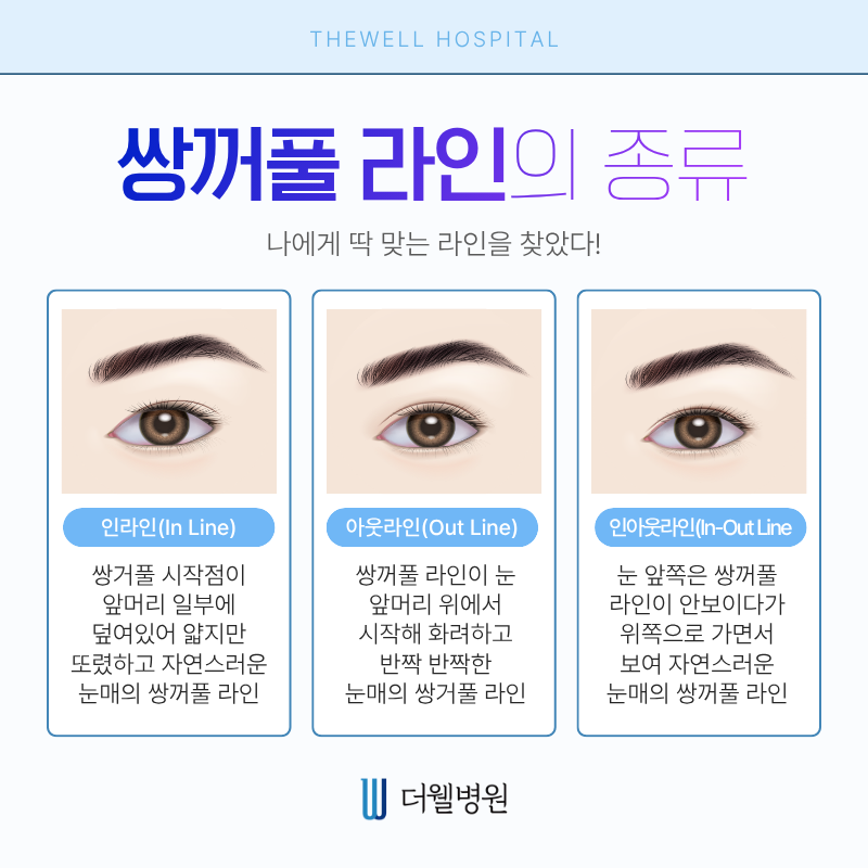 수원더웰병원 수원성형외과 수원쌍꺼풀수술 눈성형 쌍꺼풀수술방법