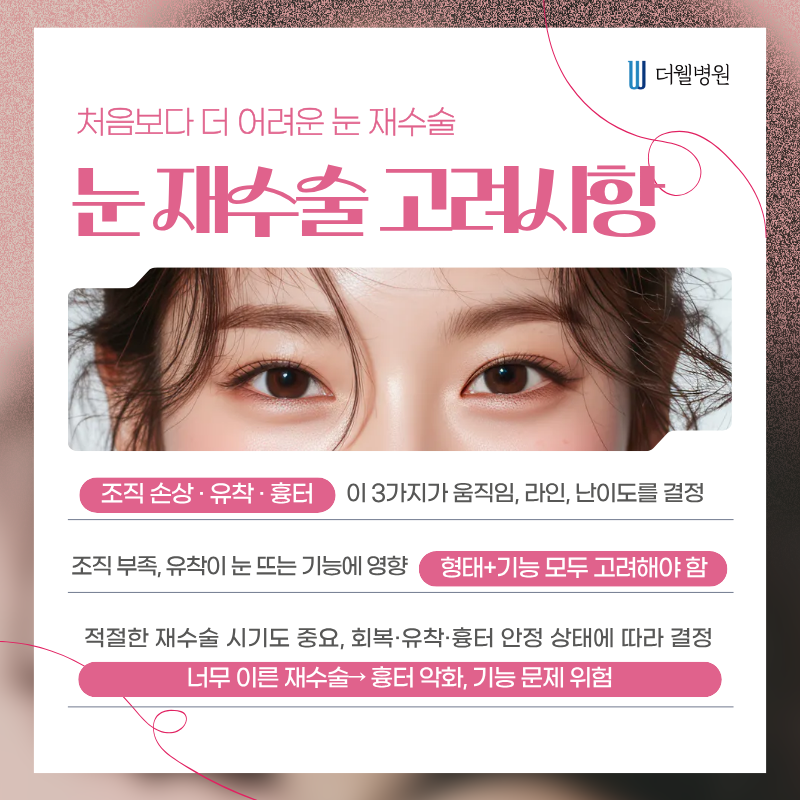 수원더웰병원 수원쌍꺼풀재수술 영통역성형외과 쌍꺼풀수술
