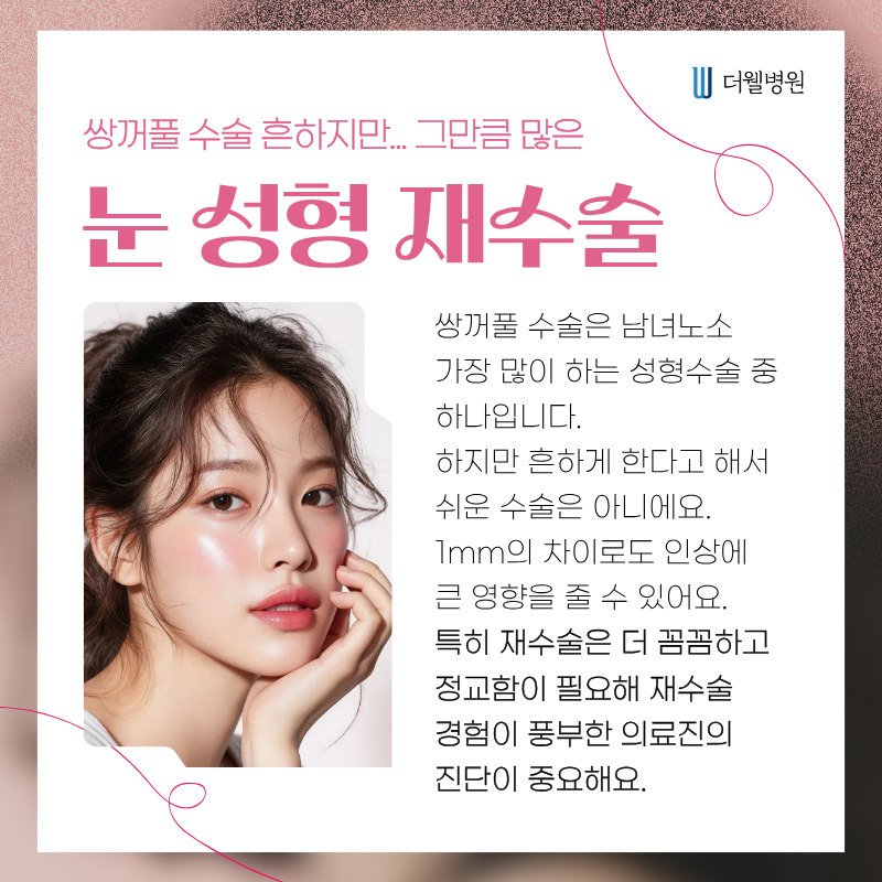 수원더웰병원 수원쌍꺼풀재수술 영통역성형외과 쌍꺼풀수술