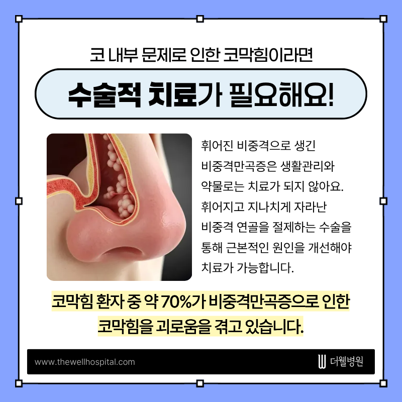비염코성형, 비염치료, 수원비염치료, 영통비염코성형